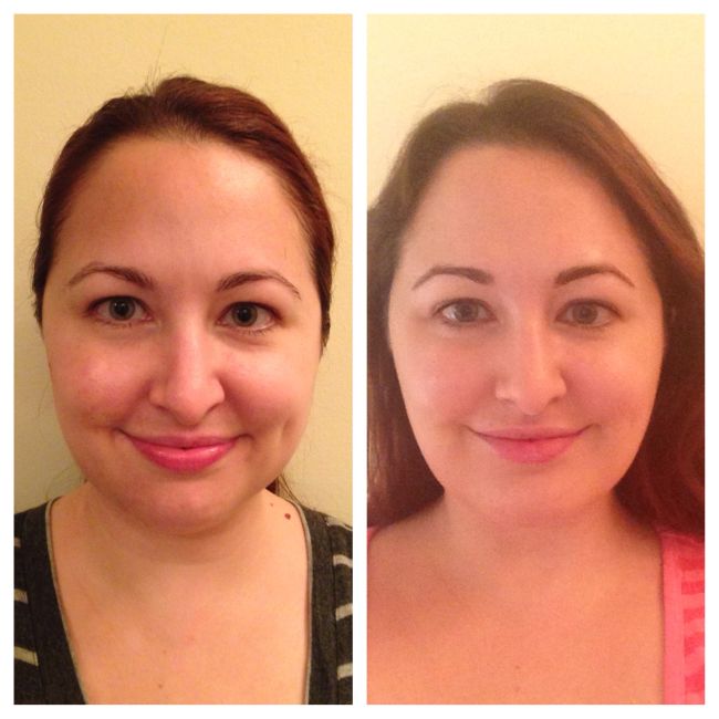My Plastic Surgery Story