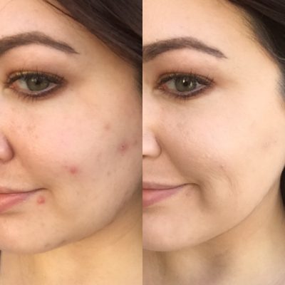 The Best Cruelty Free Foundation of All Time