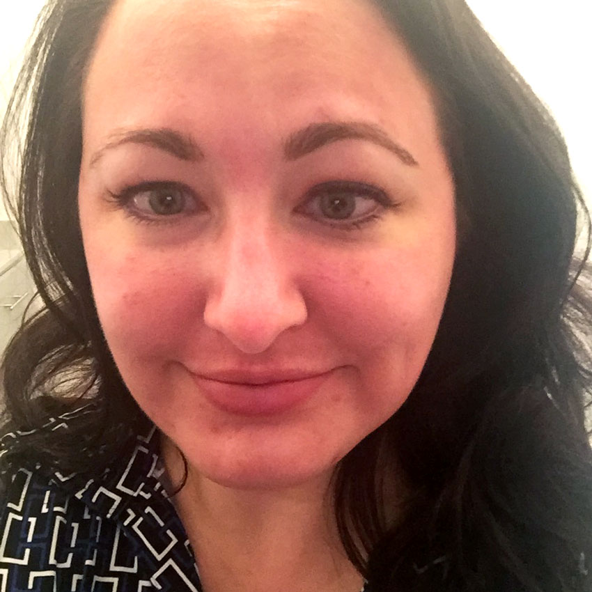 For a treatment, I chose the Clear + Brilliant Laser Treatment - it uses safe fractional laser technology to treat early signs of aging skin. - Clear and Brilliant Laser Treatment review by popular Los Angeles beauty blogger My Beauty Bunny