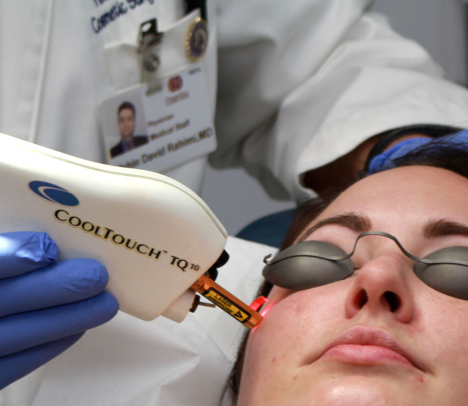 Cool Touch Laser for Acne
