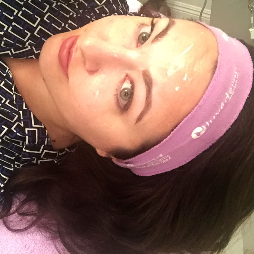 Clear + Brilliant Laser Review CRMC - Clear and Brilliant Laser Treatment review by popular Los Angeles beauty blogger My Beauty Bunny