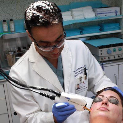 Fighting Acne with the Cool Touch Laser