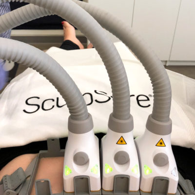 Wedding Prep: SculpSure Body Contouring at LaserXX