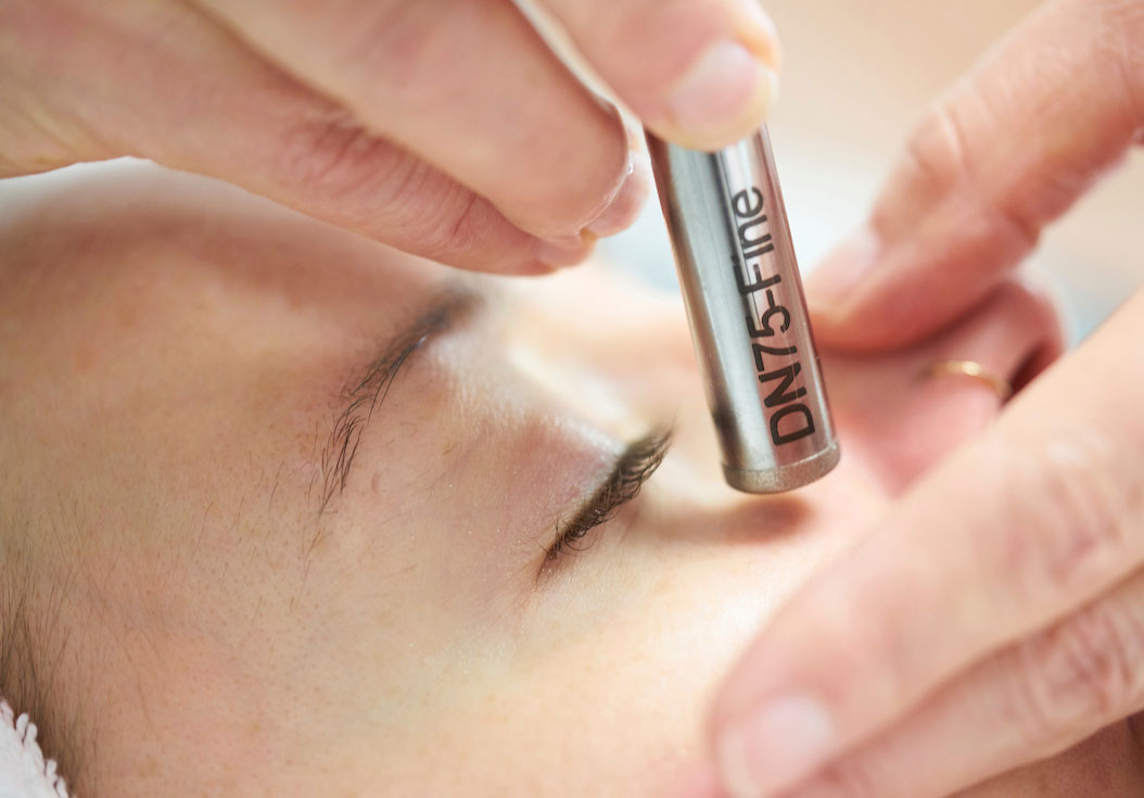 Professional Microdermabrasion at Verabella Spa - photo by Joe Kohen